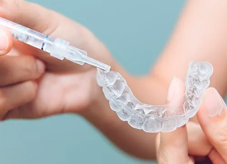 Blanqueamientos dentales